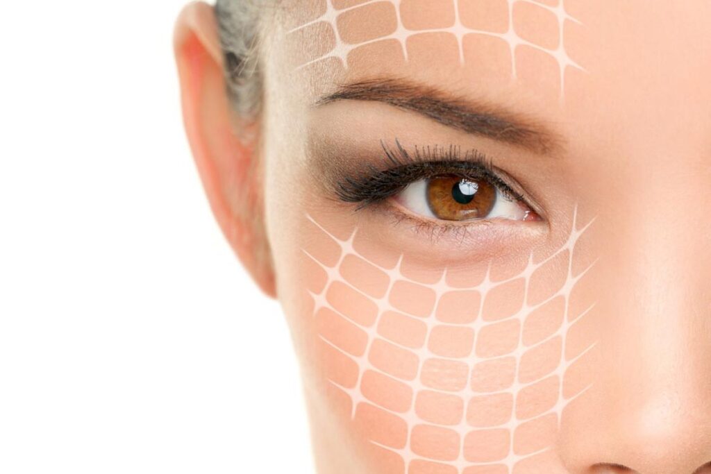 feelin eyesome karte microneedling